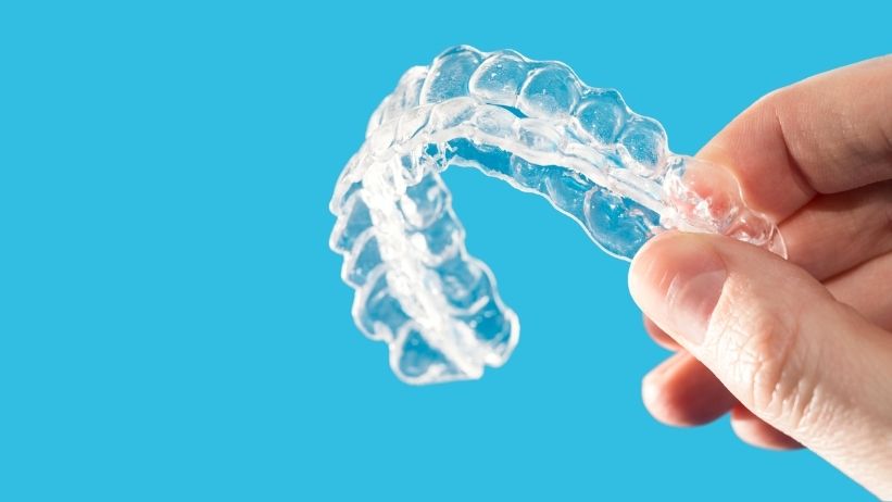 why your retainers should be your best friend